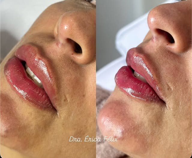 Publicação sobre cuidado labial no perfil oficial